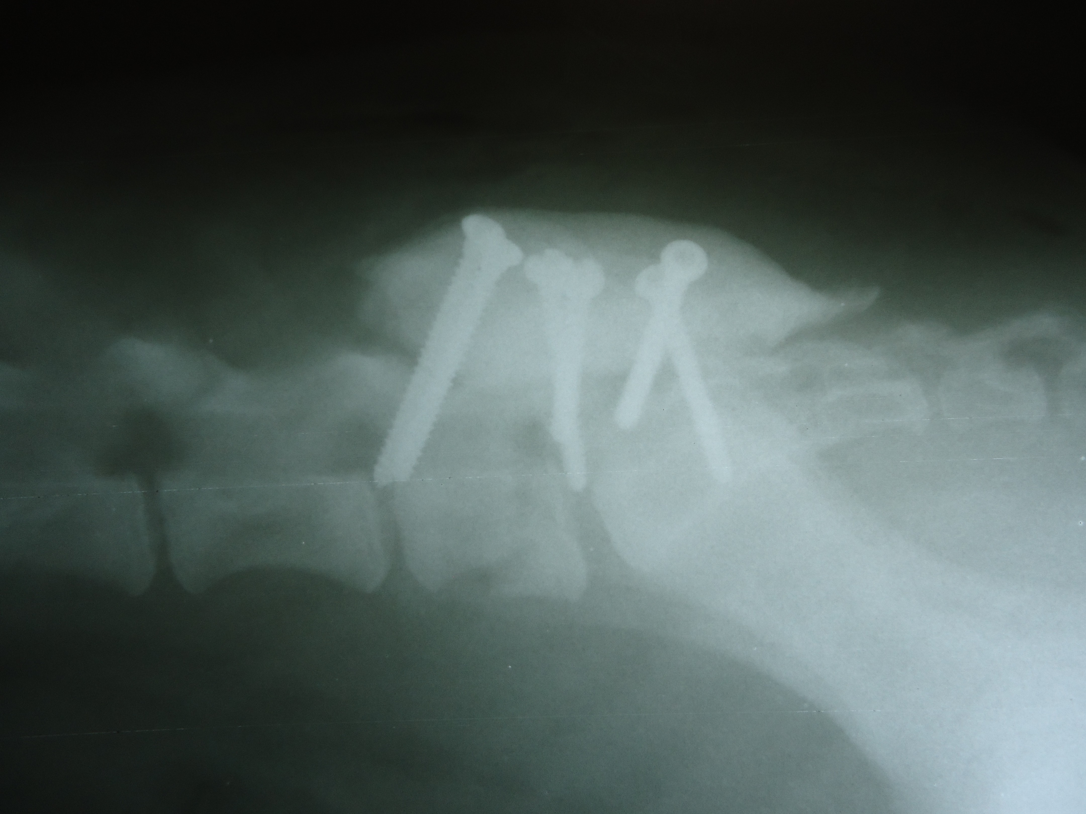 Рентген. Фиксация перелома позвоночника у собаки