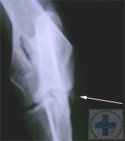 Дисплазия локтевого сустава у собаки. Фрагментированный венечный отросток. Указано стрелкой