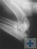 Дисплазия локтевого сустава у собаки. Дисконгруэнтность. Определяется избыточный рост лучевой кости с фрагментацией крючковидного отростка
