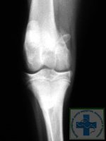 рентгенограмма латерального вывиха коленной чашечки у собаки